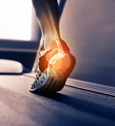 Swollen legs and ankles compression wear